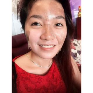 bộ mỹ phẩm thay da face tca usa