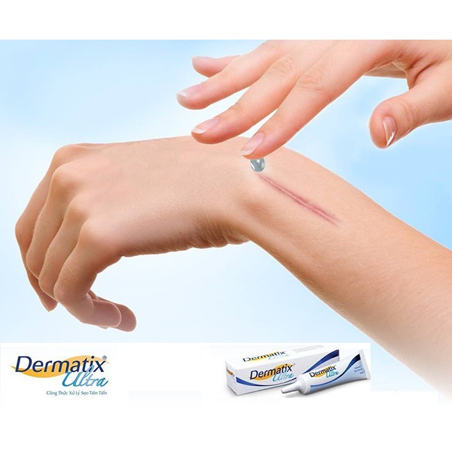 Kem mờ sẹo Dermatix Ultra tuýp 15g 7g nhập khẩu USA - làm phẳng và mờ sẹo lồi, sẹo thâm, sẹo phì đại, nám rạn da