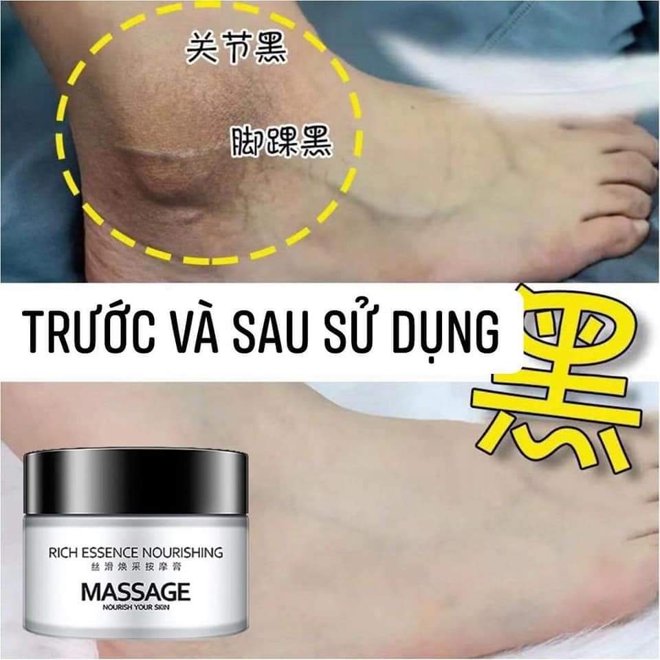 Kem PIBAMY Thải Độc Thâm Đầu Gối , Nách , Khuỷu Tay