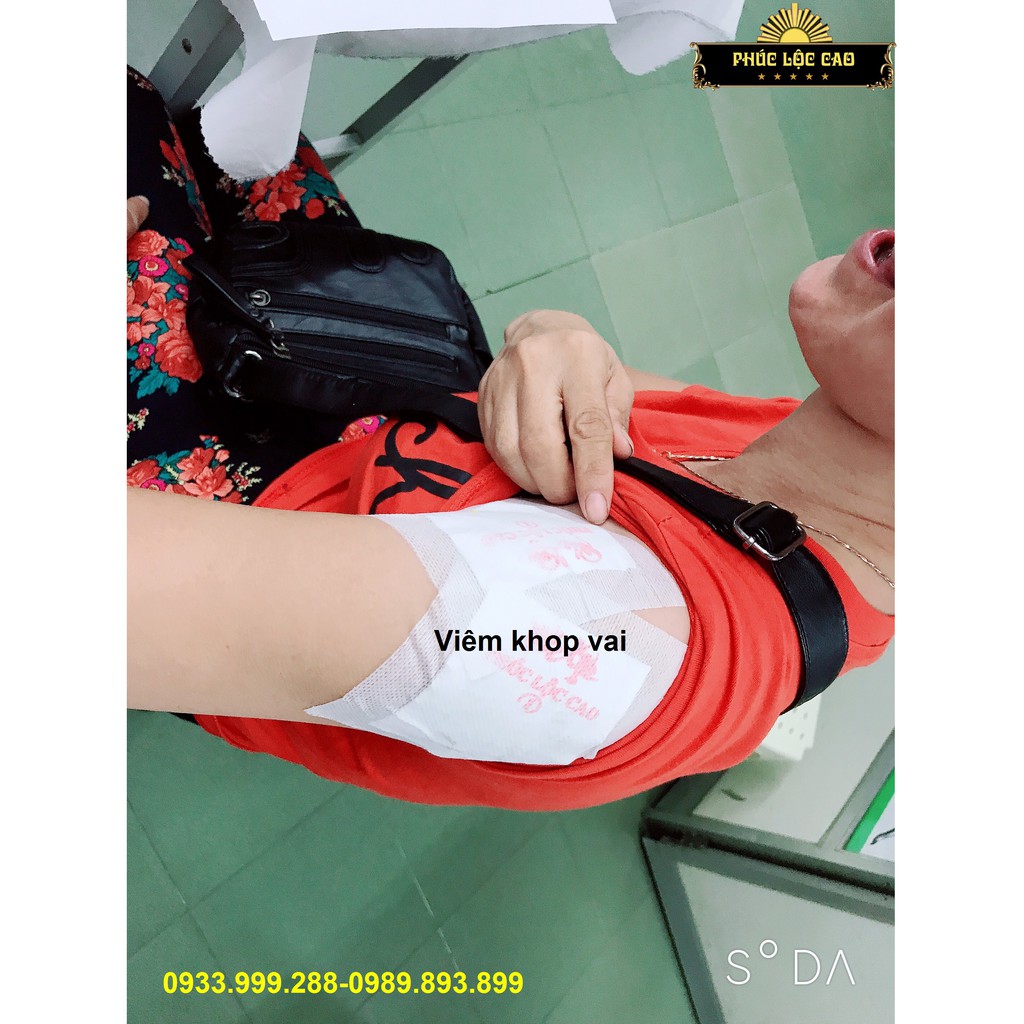 - Combo Hộp 20m Cao khỏi đau xương khớpPhúc Lộc