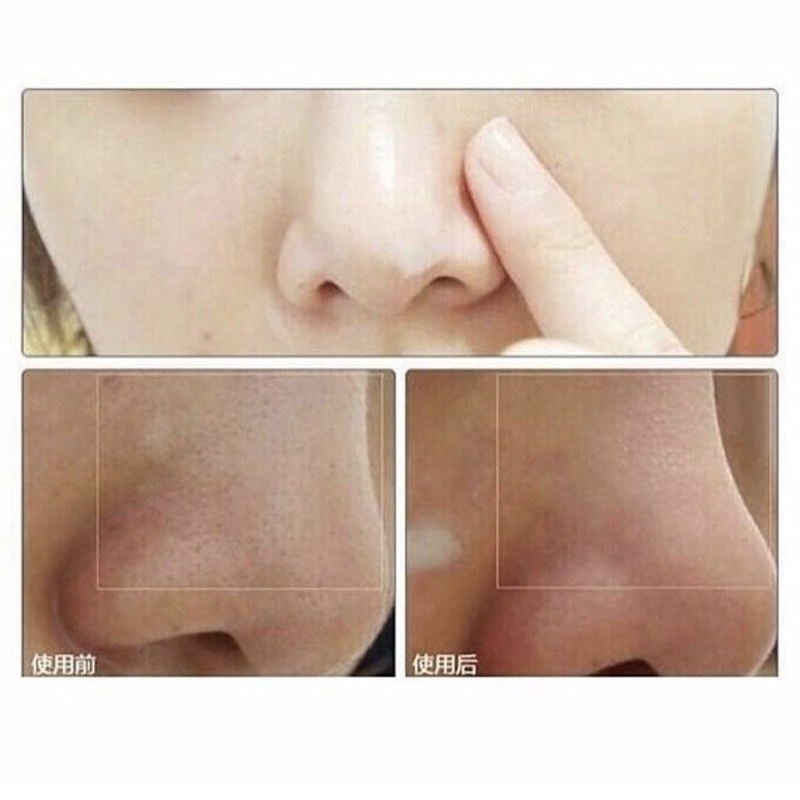 Sáp giảm mụn đầu đen INNSFREE JEJU VOLCANIC BLACKHEAD OUT BALM