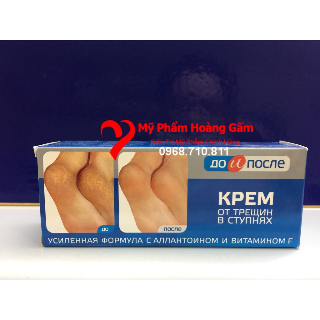 Kem Nứt Gót Chân Nga Kpem Apteka Nga 50ml