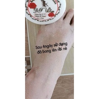 KEM BODY BONG DA