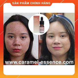 Tinh Chất CARAMEL ESENCE Hãng Nhật Bản
