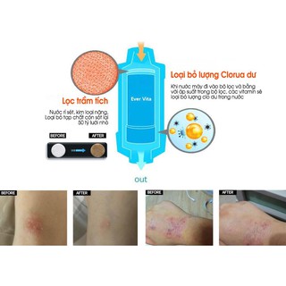 LÕI LỌC NƯỚC VÒI SEN VITAMIN C - EVERVITA HÀN QUỐC