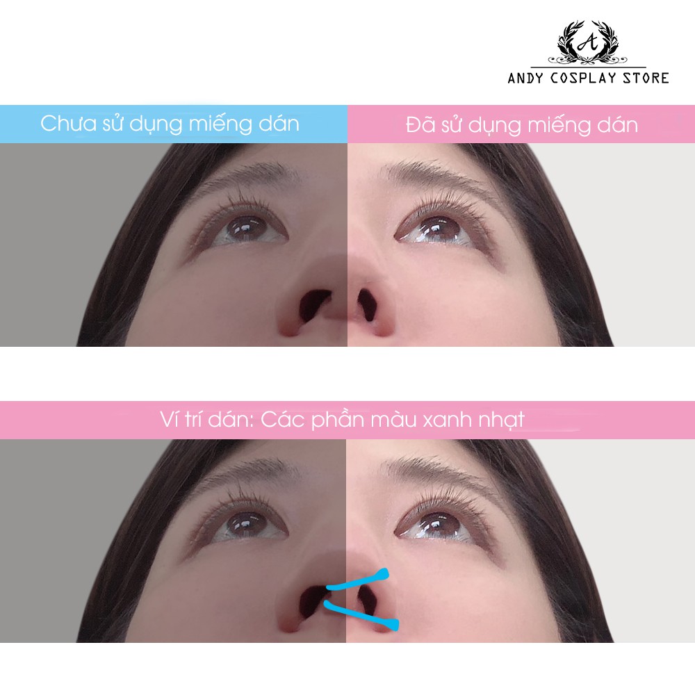 [CÓ SẴN] Miếng dán thu gọn mũi Assist Wig
