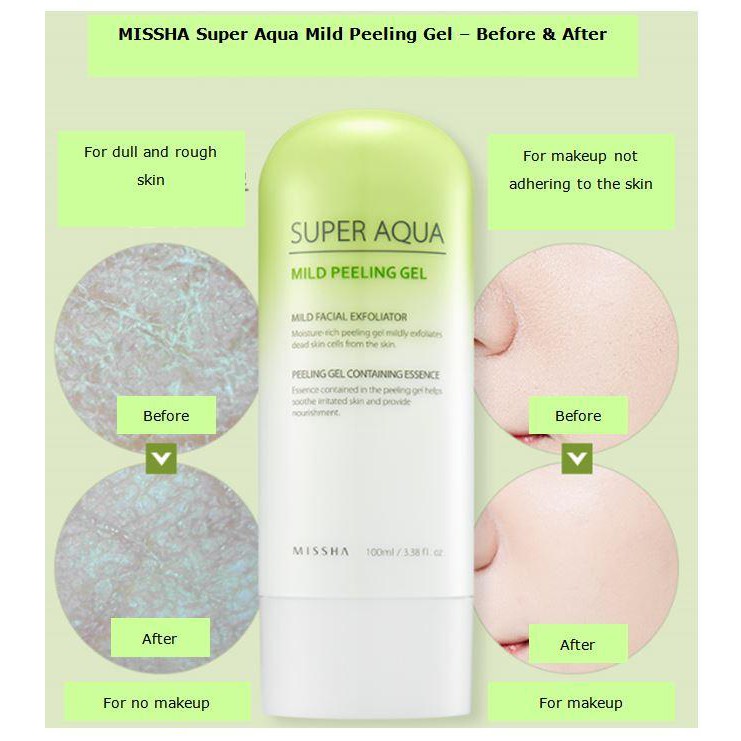 Tẩy da chết Missha Super Aqua Mild Peeling Gel