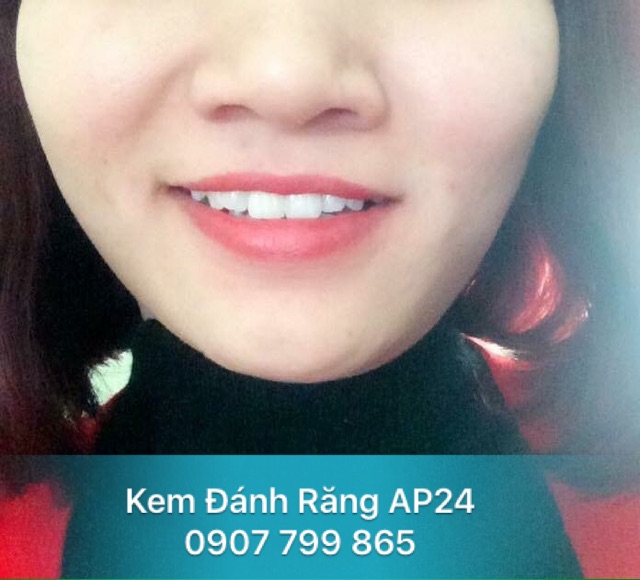 [CHUYÊN SỈ - INBOX] KEM ĐÁNH RĂNG AP24