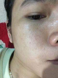 Tavida da xấu thành đẹp