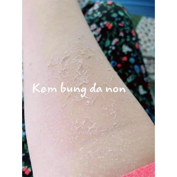 KEM BODY BONG DA- Tái tạo lại làn da- Loại bỏ vùng da thâm - sạm - khô ráp- Nâng tông da nhanh