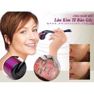 Máy lăn kim cao cấp ZGTS nititan - Triệt tiêu mụn và lỗ chân lông