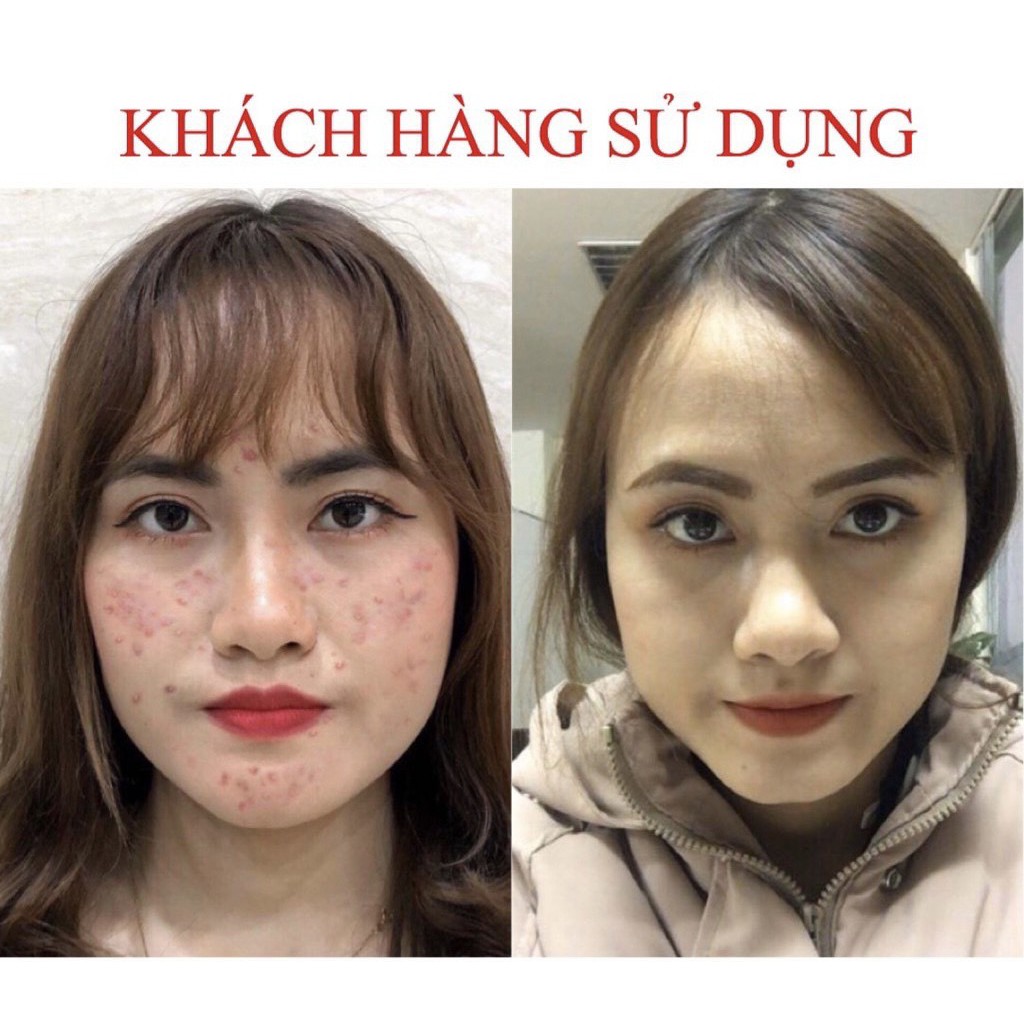 Serum giảm mụn thâm rỗ Seimy - Skin 7 Days - Công dụng 5 trong 1 hiệu quả 7-14 ngày