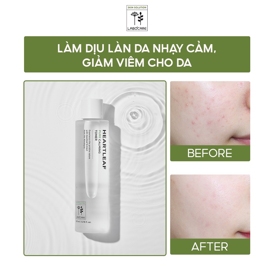 Nước Hoa Hồng Làm Dịu Da Chiết Xuất Diếp Cá Labocare Heartleaf Pure Calming Toner 200ml