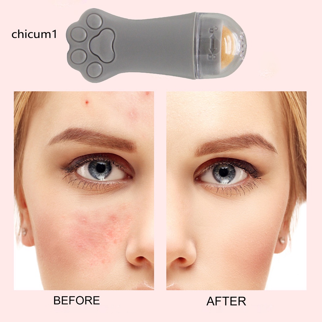 [Hàng mới về] Cây lăn mát xa mặt vùng chữ T loại bỏ mụn đầu đen chăm sóc da