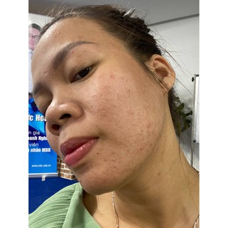 Gel bạc diệt khuẩn TRUSILVR
