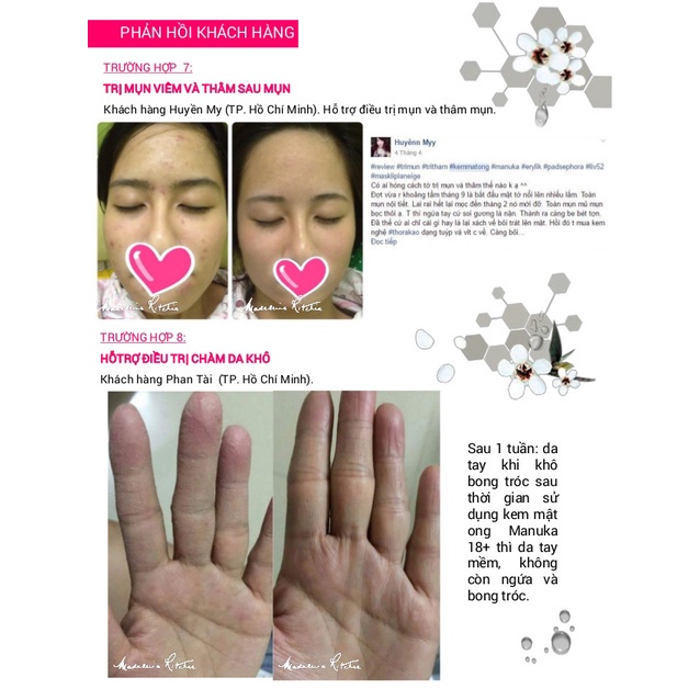 [Hỏa tốc] Kem Mật Ong Manuka 18+ Giảm Mụn, Mờ Thâm, Làm Dịu Da Dị Ứng Skin Health Crème hàng chính hãng