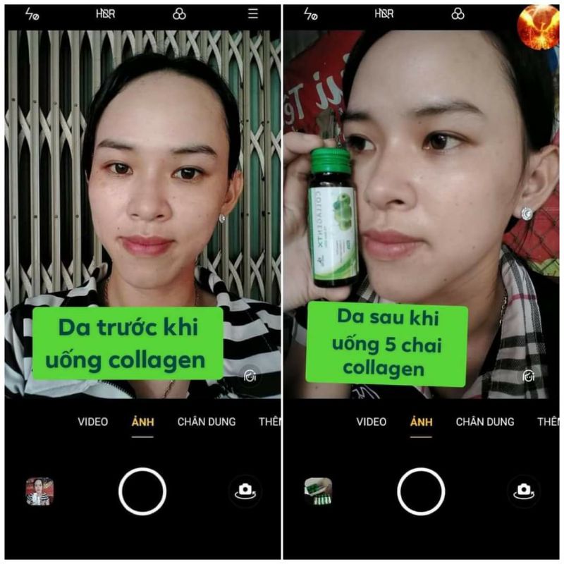 Colagen tế bào gốc tặng mặt nạ đẹp da