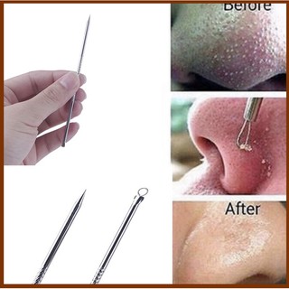 Que nặn mụn thép không gỉ dài 8cm