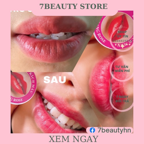 [Hàng Mới Về] Son Dưỡng Môi,Giảm Thâm Loang ROSE [Hũ 10Gr]