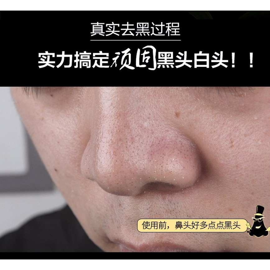 1 Túi Mặt Nạ Bùn Khoáng Thu Nhỏ Lỗ Chân Lông Loại Bỏ Mụn Đầu Đen Hiệu Quả