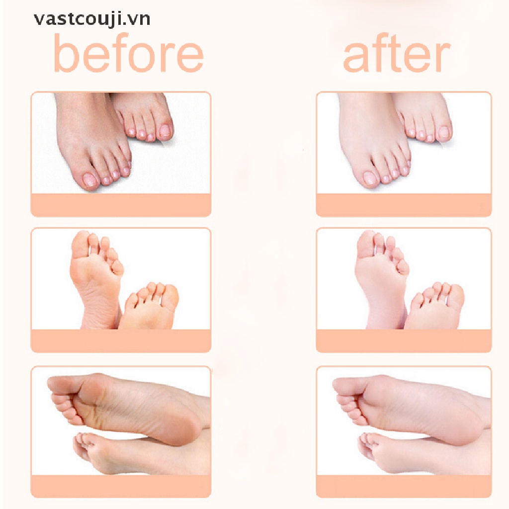 Túi 2 Mặt Nạ Chân Tẩy Tế Bào Chết Cứng Cáp