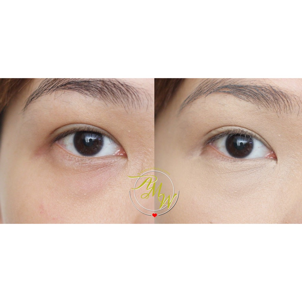 Set che khuyết điểm toàn diện Clio Kill Cover Pro Artist Liquid Concealer - 3 món (Màu 03BY - da sáng, da tự nhiên) | BigBuy360 - bigbuy360.vn