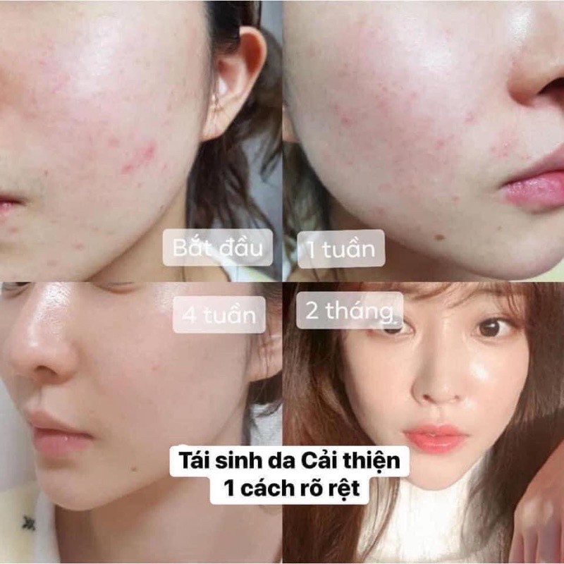 Tinh chất vàng đêm Sum Losec Summa Elixir Night ampoule đêm se khít lỗ chân lông sáng da ngừa thâm nám 1ml