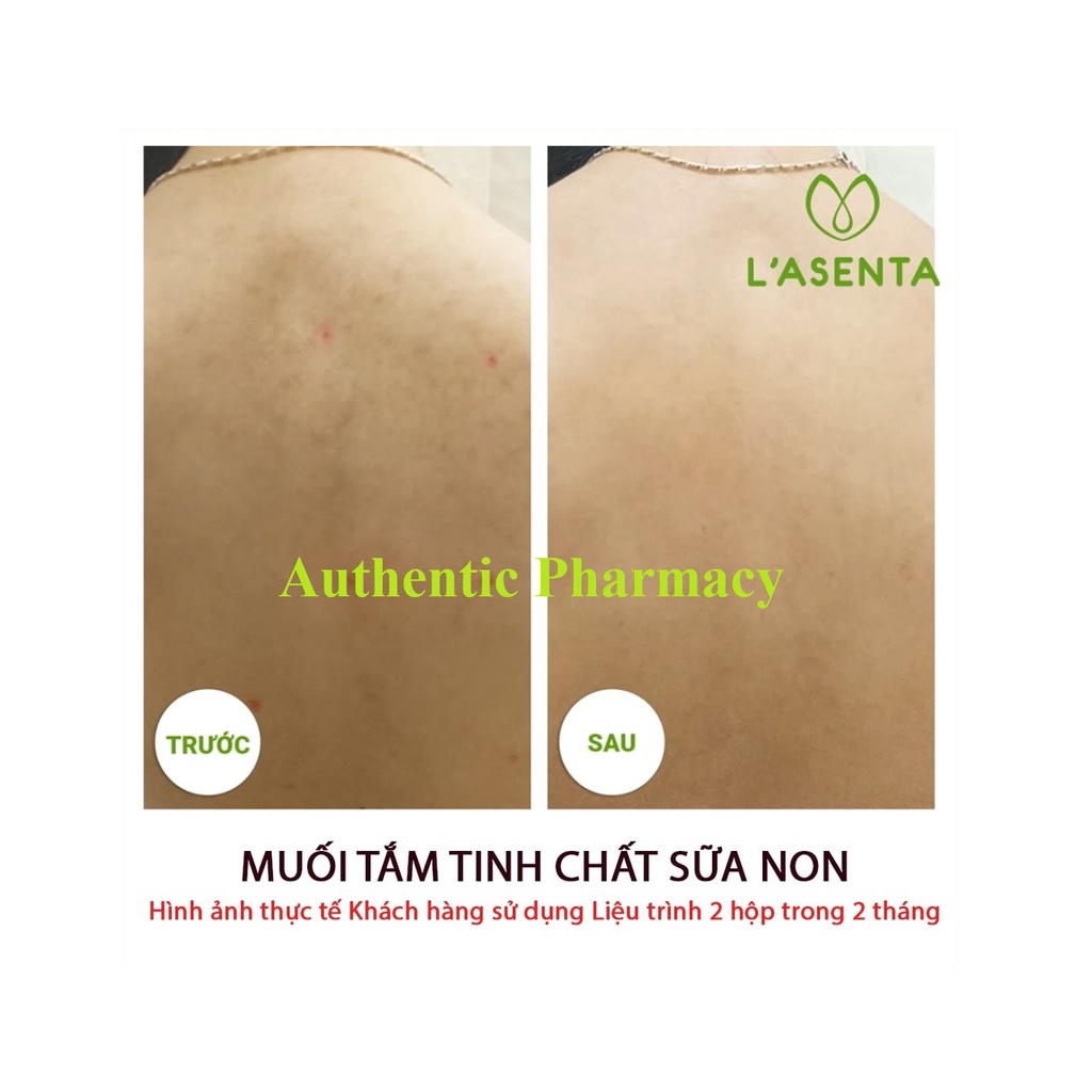 Muối Tắm Tinh Chất Sữa Non L'asenta - Loại Bỏ Mụn Lưng, Viêm Nang Lông, Tẩy Tế Bào Da Chết Boby | BigBuy360 - bigbuy360.vn