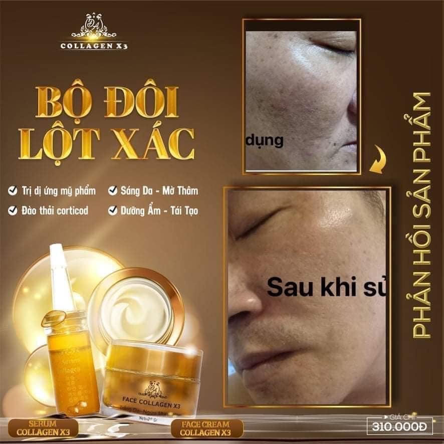 Serum nám X3 collagen 20ml Chính hãng