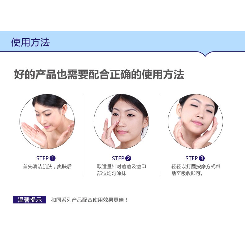 Kem Ngừa Mụn Pure Skin Bioaqua Viêm, Mẩn Đỏ, Sưng Tấy, Mờ Sẹo, Thâm Mụn, Thu Nhỏ Lỗ Chân Lông, Kiểm Sát Dầu Chính Hãng | BigBuy360 - bigbuy360.vn