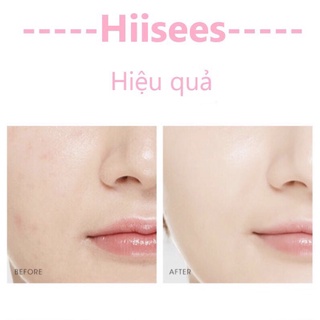 Kem nền che khuyết điểm