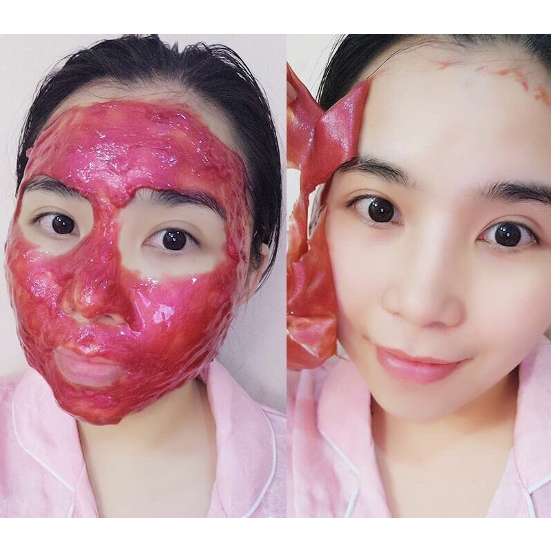 Mặt nạ hoa hồng đỏ (DNA cá hồi) dưỡng trắng da