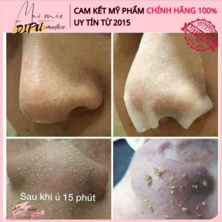 Ủ Mụn Medi-Peel Extra Super9- 50-100ml Mụn Cám Mụn Đầu Đen, Mụn Cám | BigBuy360 - bigbuy360.vn