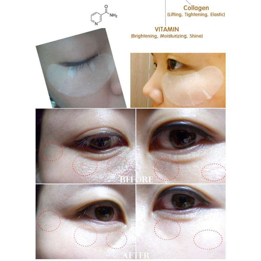 Mặt nạ mắt Collagen hết thâm quầng mắt hiệu quả, an toàn Eye Zone Mask Purederm Hàn Quốc túi gồm 30 miếng