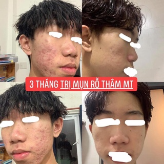 Tái Tạo Da MT (50ml)