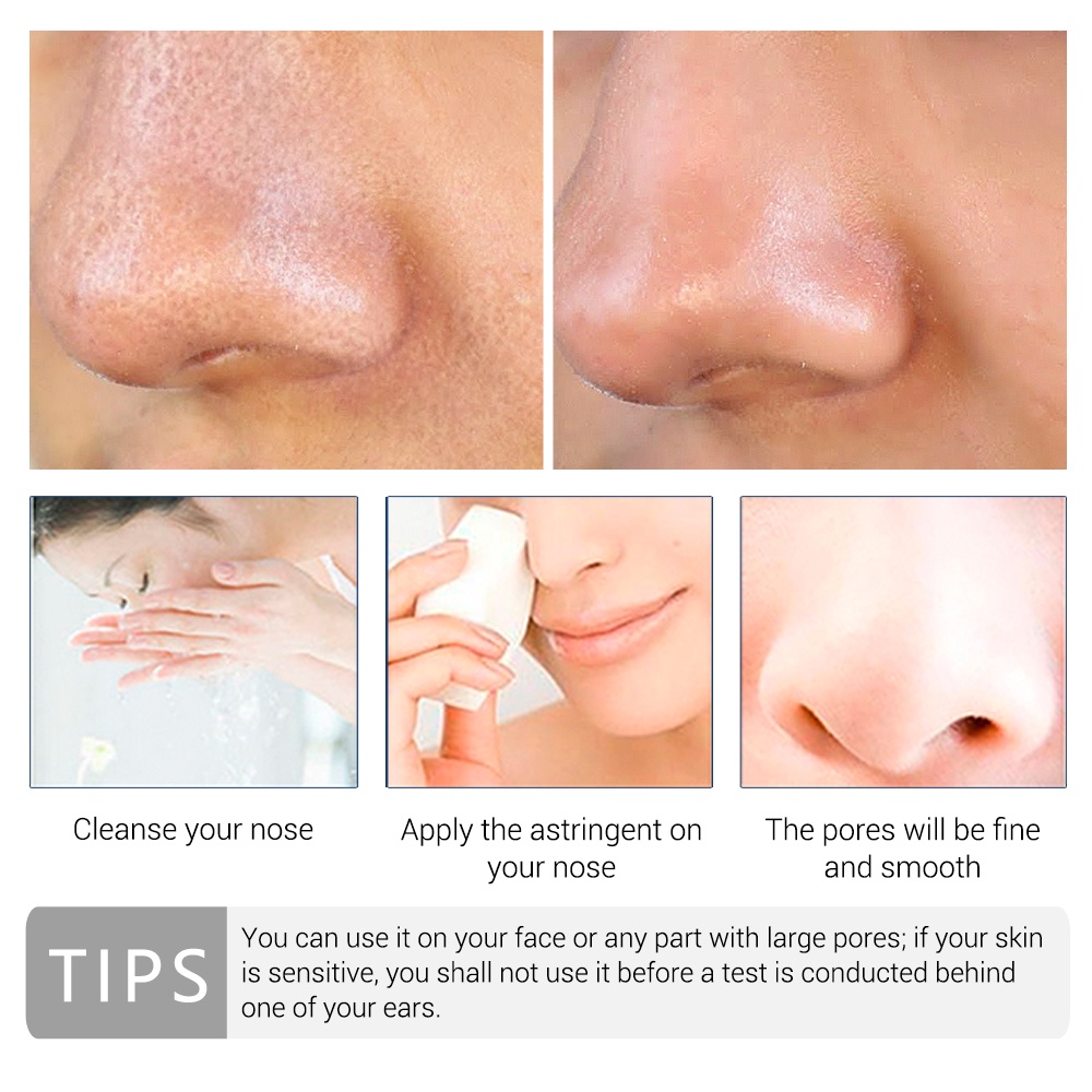 Serum Hyaluronic Acid Dưỡng Ẩm Se Khít Lỗ Chân Lông Và Phục Hồi Da Khô