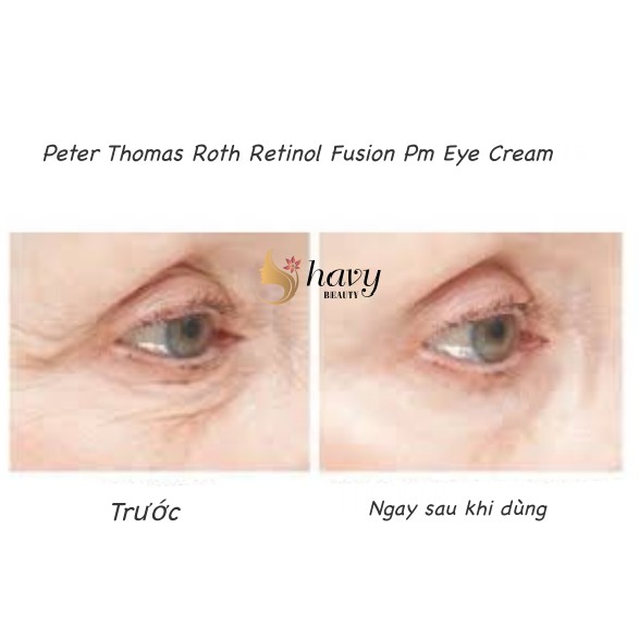 peter thomas roth eye retinol
