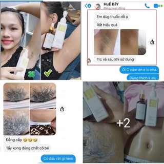 Combo triệt lông Huyền Phi chính hãng