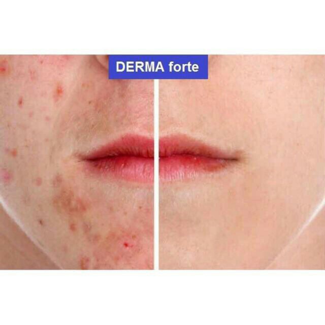 Derma Forte Gel - ngừa mụn, giảm thâm mụn (15g) | BigBuy360 - bigbuy360.vn