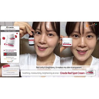 Kem mụn trứng cá CIRACLE Red Spot Cream