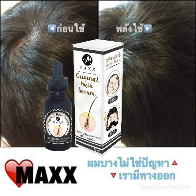 Serum ƙích nang lông Maxx Original Hair