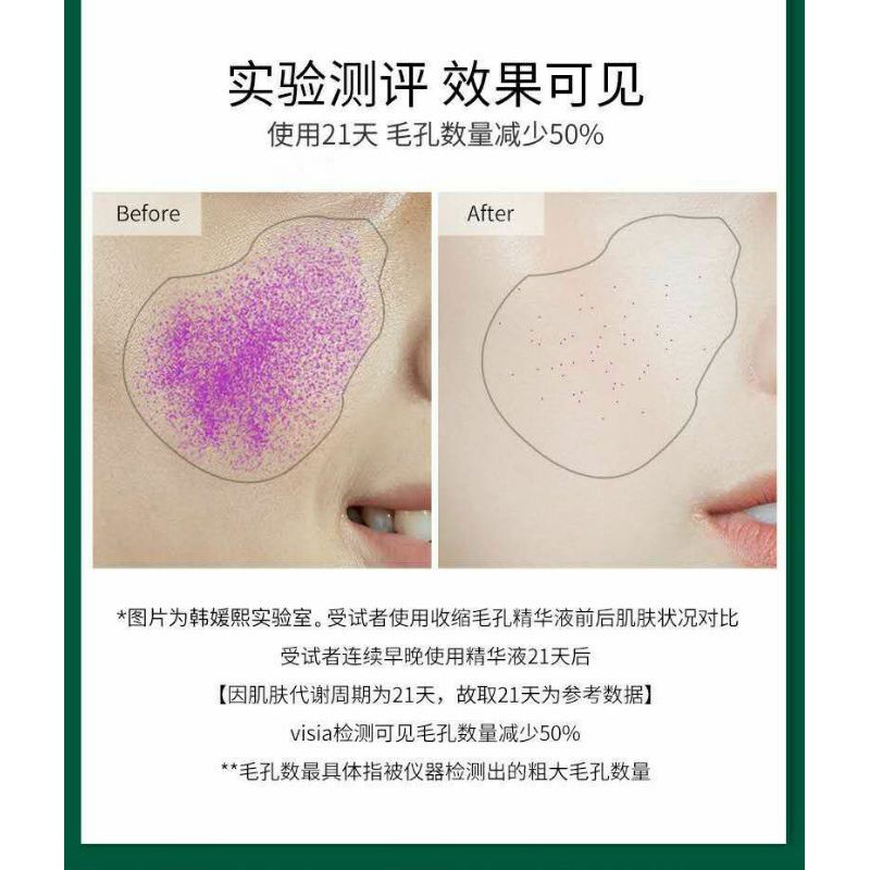 Serum thu nhỏ lỗ chân lông heyx JM nội địa trung | BigBuy360 - bigbuy360.vn