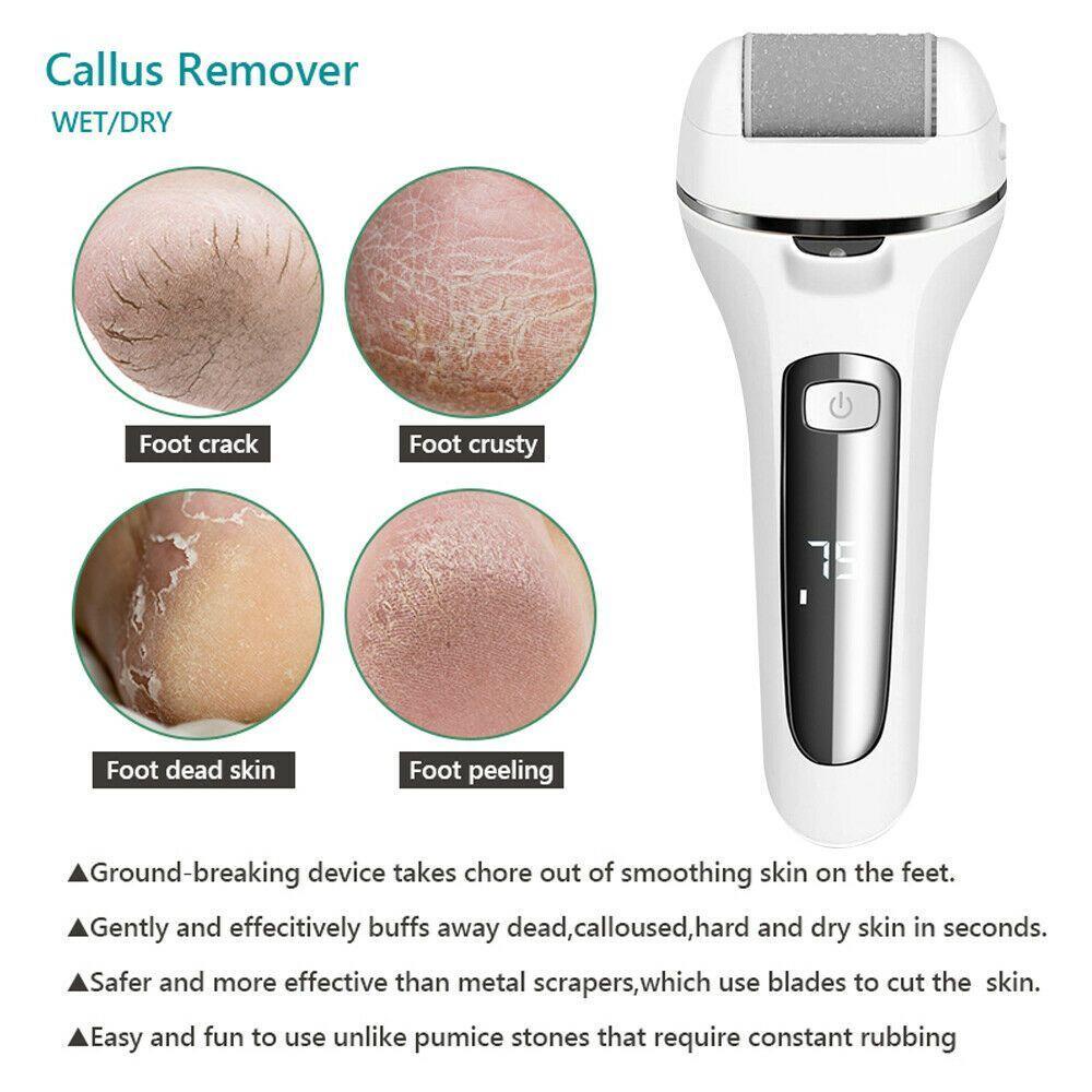 WATTLE Dụng Cụ Tẩy Tế Bào Chết Cho Bàn Chân Loại Bỏ Vết Chai Cứng