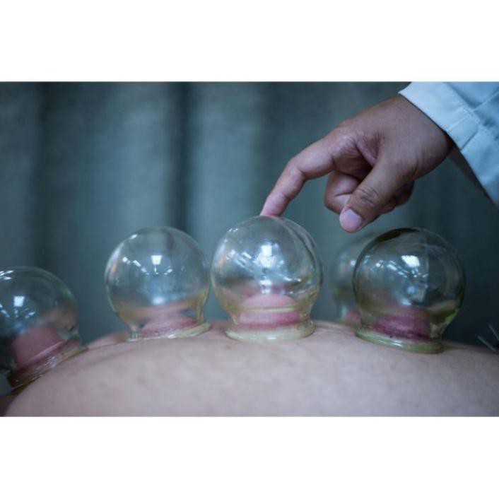 Bộ giác hơi dùng lửa thủy tinh 12 cốc
