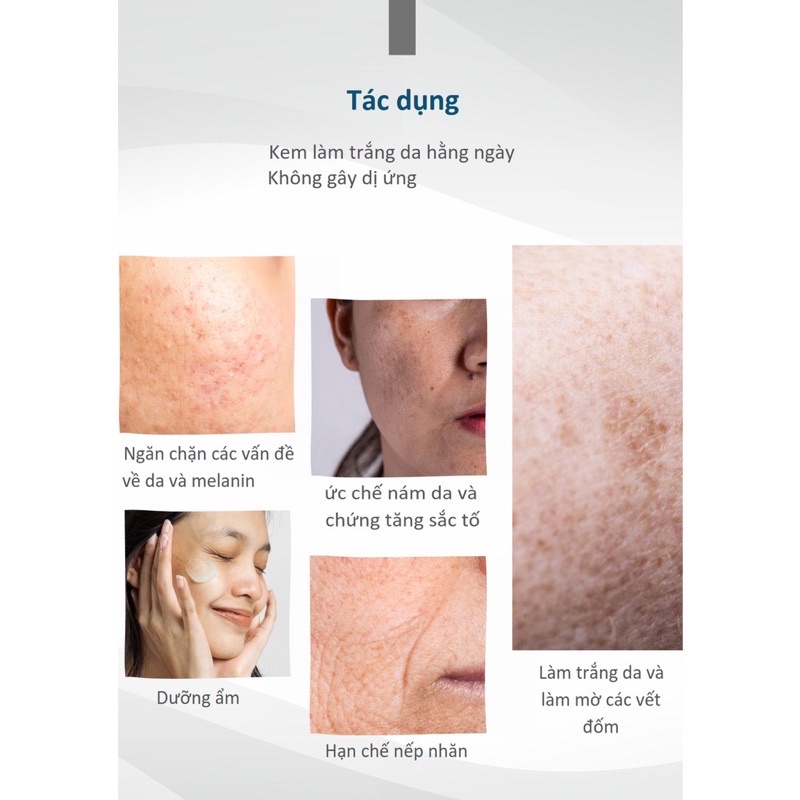 Kem sáng da, mờ thâm nám với hoạt chất Arbutin, Tranexamic, Glutathione - GLUTANEX Spot Cream