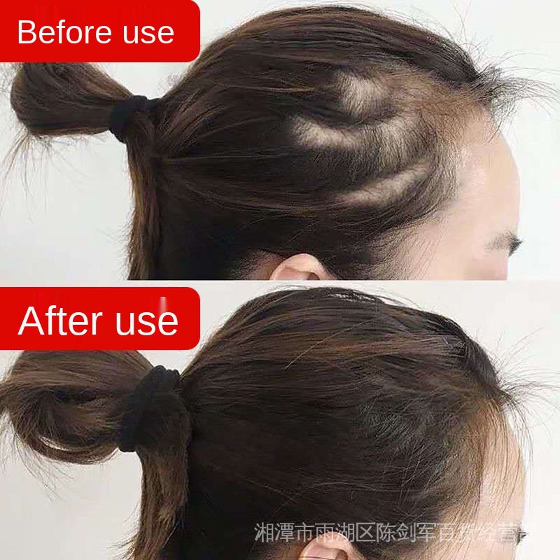 Dầu gội kích mọc tóc chống rụng tóc hiệu quả có bán lẻ