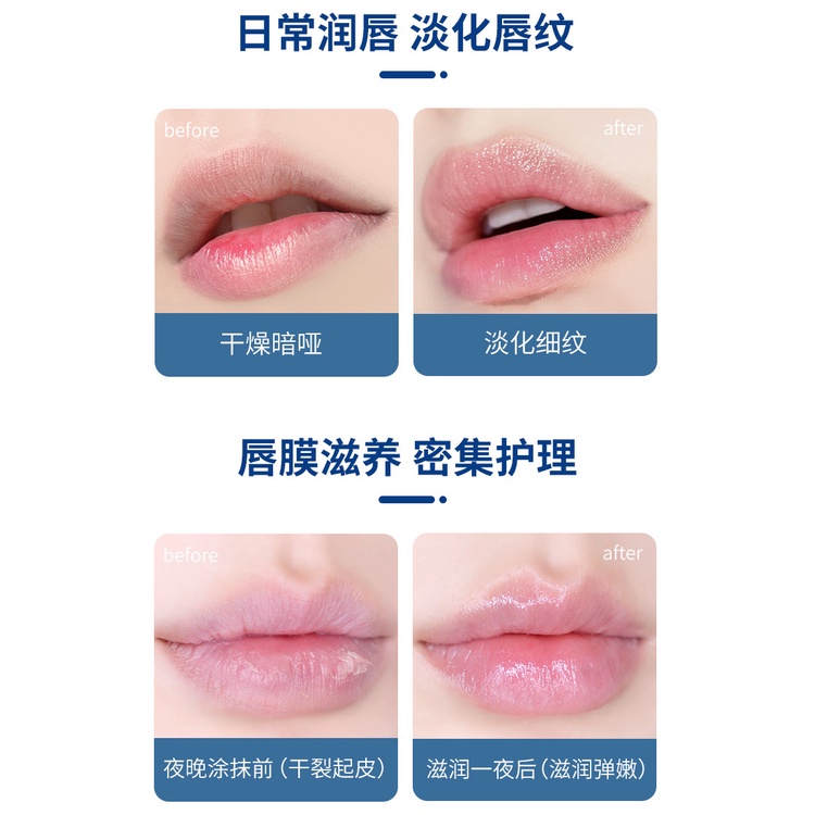 Hộp 4 Hũ VASELINE 7g Dưỡng Môi Đủ Vị Trái Cây