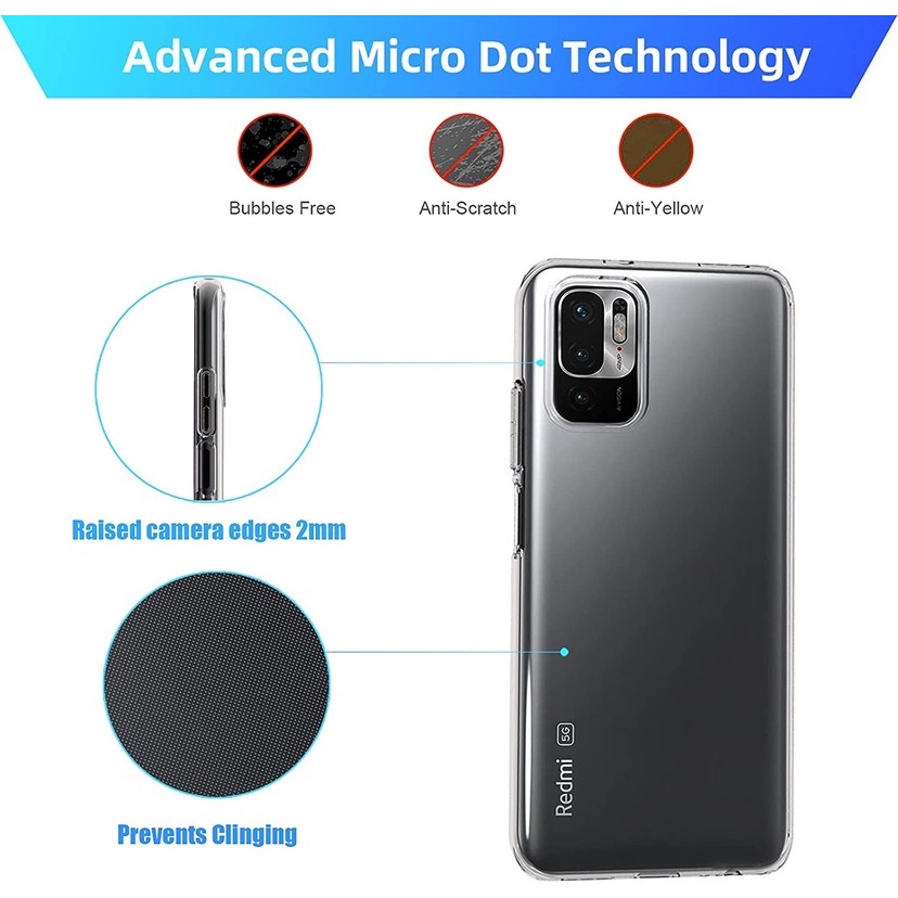 Ultra Ốp Điện Thoại Cho xiaomi 11t 12t 13t note 12s 11s 10s 9s 8 7 pro redmi 12c 10c a1 a2 plus poco f5 x5 m5s f4 x4 x3 f3 gt m3 c40 mi 11 lite 9t pro Dụng Cụ Làm Móng Bằng Silicon Tiện Dụng Và Bền
