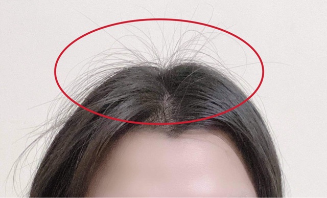 Xịt dưỡng tóc VIJULLY hair lotion