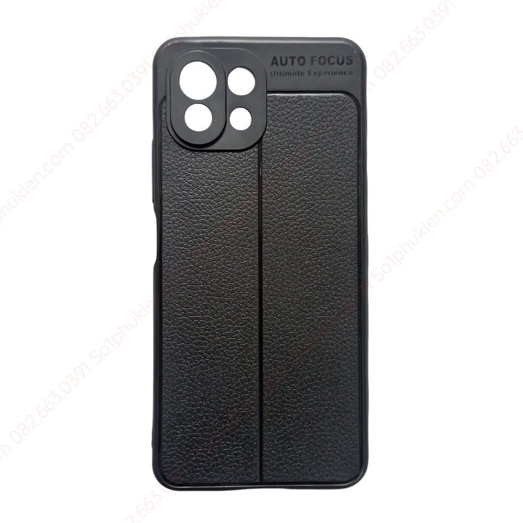 Ốp lưng Xiaomi Mi 11 Lite / Mi 11 Lite 5G / Mi 11 Lite 5G NE dẻo đen auto giả vân da bền đẹp, có bảo vệ từn